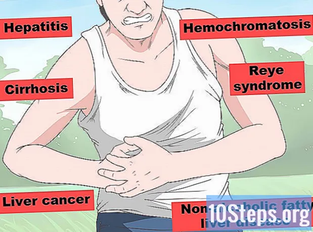 Kako zaustaviti bolove u jetri
