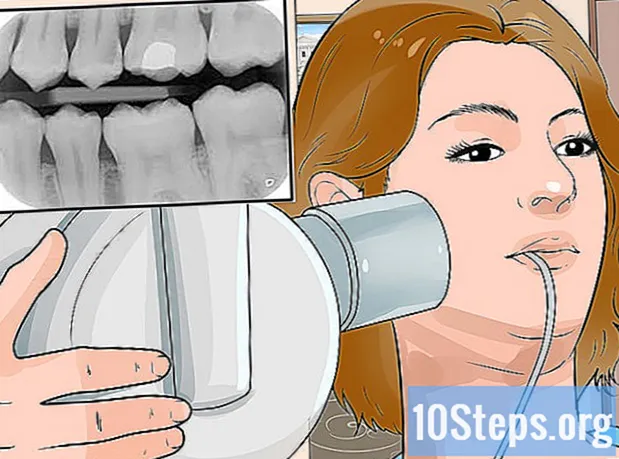 Wie Sie Ihre Zähne natürlich aufhellen - Enzyklopädie