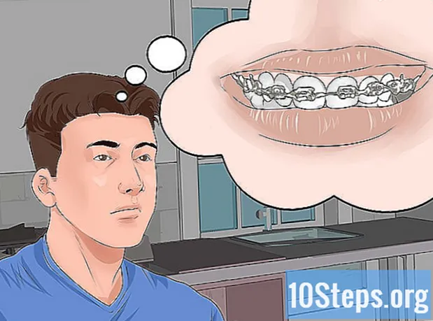 Ortodontik Diş Teli Kullanımından Nasıl Kaçınılır - Ansiklopedi