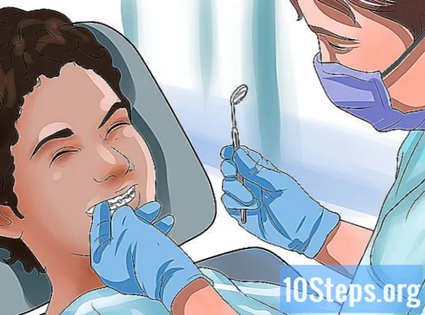 Sådan rengøres tænder med tandreguleringsapparat