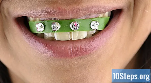 Hoe maak je een nep-orthodontisch apparaat