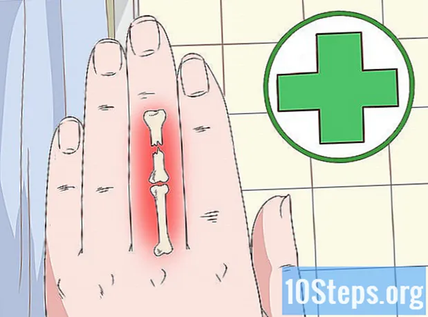 Kako se nositi s bolom zatvorenih vrata na prstu - Enciklopedija