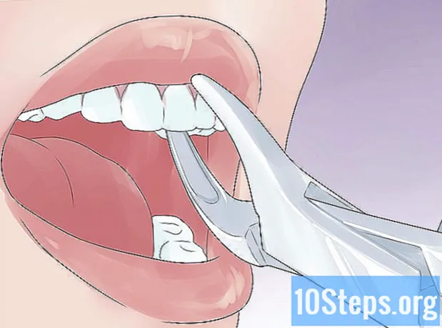 Hur man skyddar en flisad tand