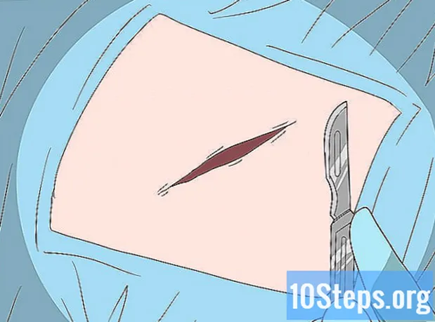 Hvordan fjerne knust glass fra sår