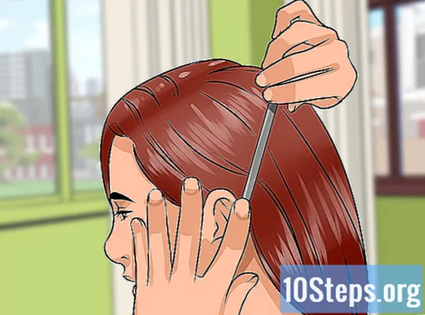 Πώς να αφαιρέσετε ένα Blackhead από το μέτωπο