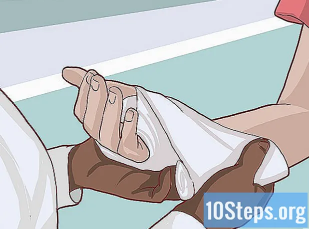 Cómo saber si rompiste tu nudo - Enciclopedia