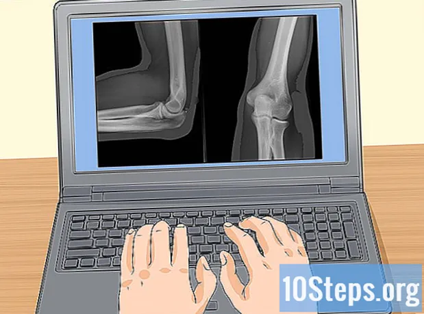 Cum să vă pregătiți pentru o radiografie