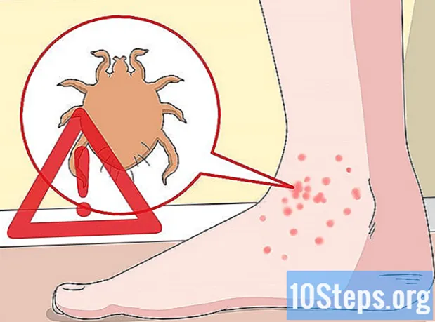כיצד לטפל ברגליים מגרדות