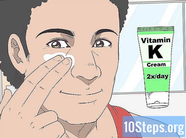 Hur man behandlar blåmärken i ansiktet