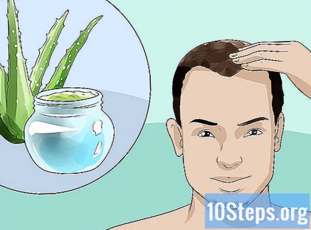 Jak zacházet s mužskou plešatostí - Encyklopedie