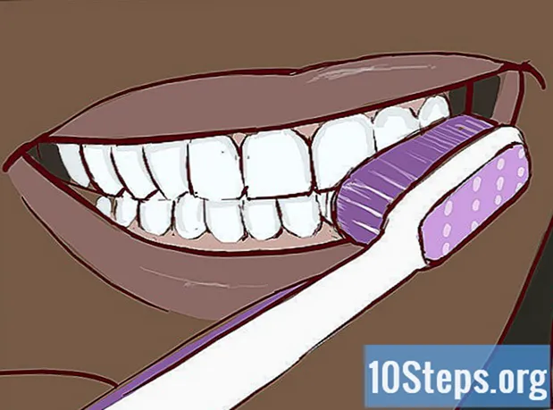 Cómo tratar un diente roto - Enciclopedia