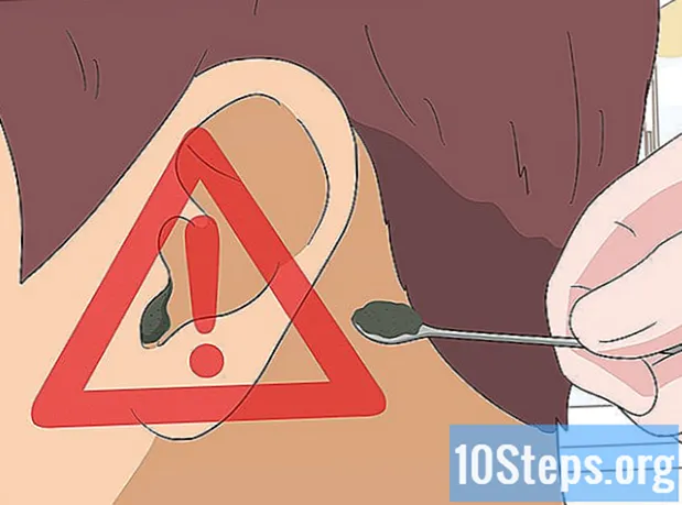 Cum să tratezi o durere de ureche