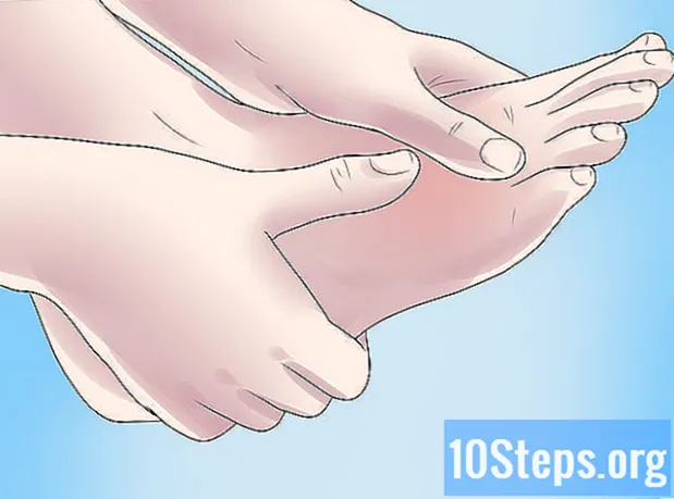 Kako liječiti prijelom stresa na stopalu
