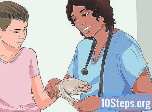 Cum să tratezi o arsură de mână