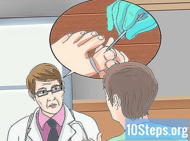 Com tractar les ungles encarnades
