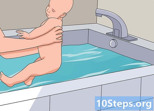 Как да успокоява сърбящата варицела