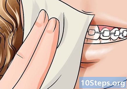 Hur man applicerar tandvax på ringar