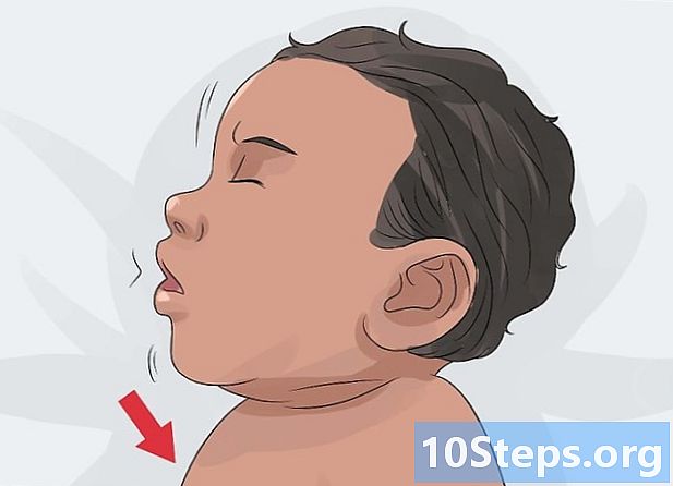 아기의 수막염 증상을 감지하는 방법