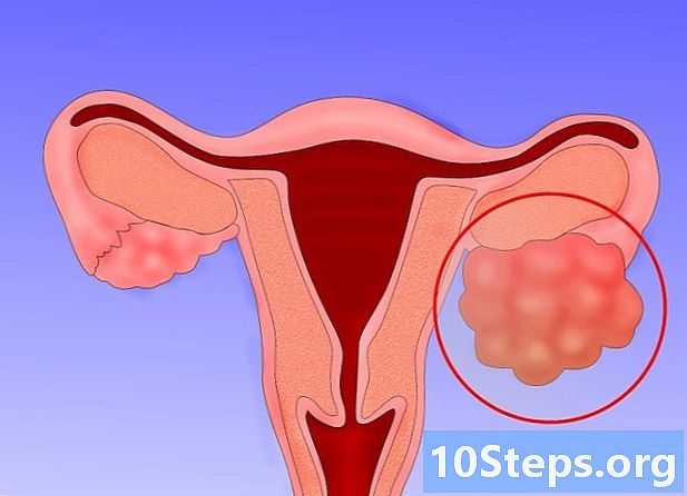 卵巣癌を検出する方法