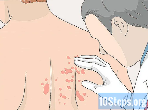 Як доглядати за шкірою після шугарингу
