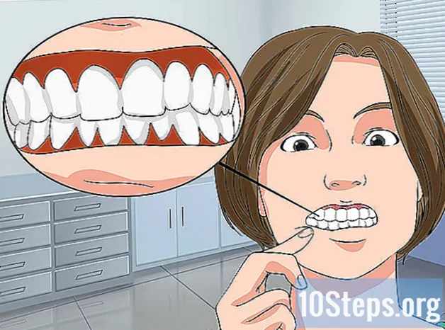 Sådan helbredes hævede tandkød