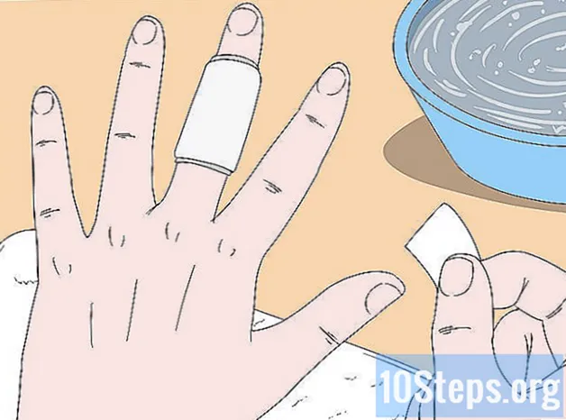 Kuinka parantaa tartunnan saanutta sormea