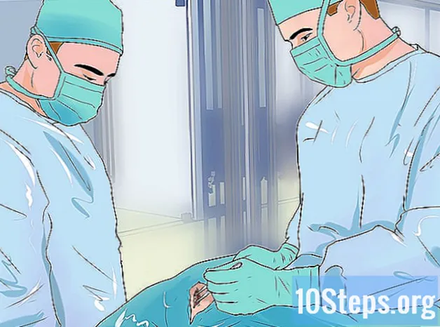 Kako dijagnosticirati aortnu regurgitaciju - Znanjima