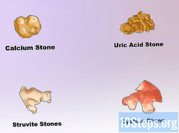 Как да разтваря камъни в бъбреците