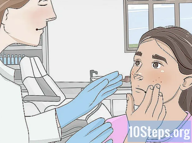 Hoe zich op natuurlijke wijze van acne littekens te ontdoen