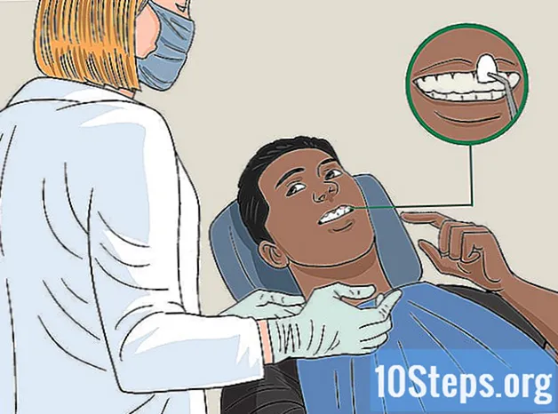 Πώς να απαλλαγείτε από κίτρινα δόντια