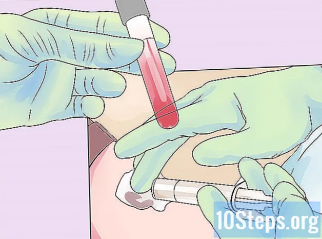 Làm thế nào để xác định các triệu chứng chảy máu đường tiêu hóa trên - KiếN ThứC