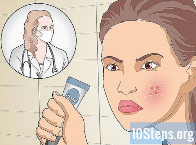 Hoe u natuurlijk acne kunt voorkomen