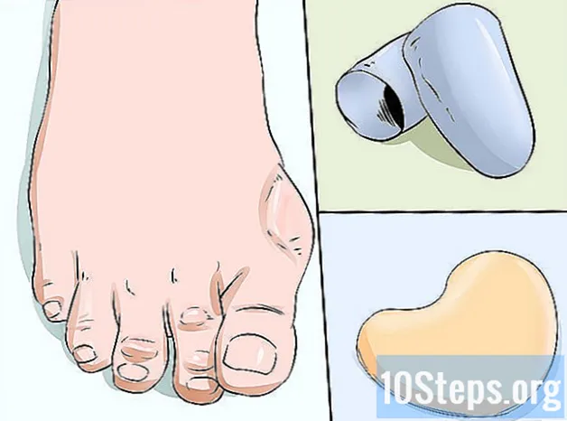 Cum să preveniți calusurile pe mâini - Cunostinte