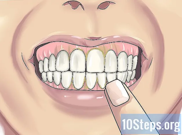 Hoe vage tanden te voorkomen
