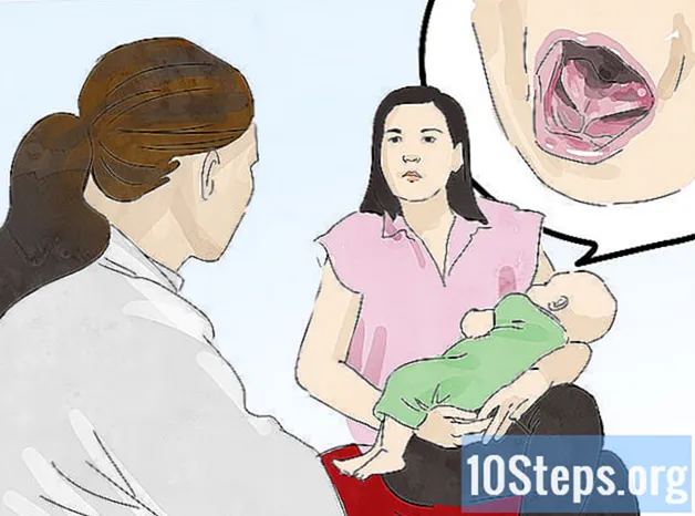 Hogyan lehet megakadályozni a fájdalmas szoptatást