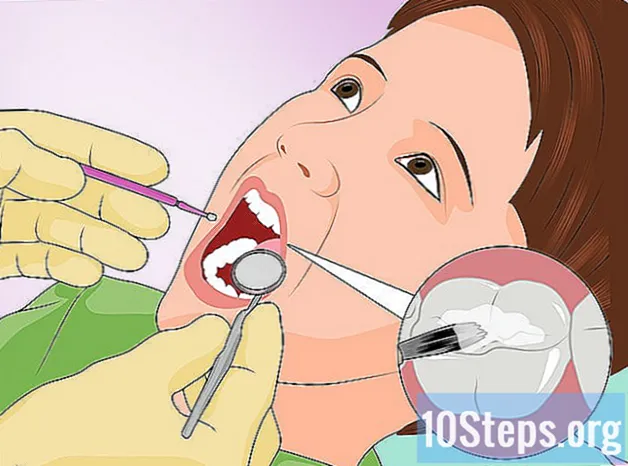 Jak chronić zęby dziecka