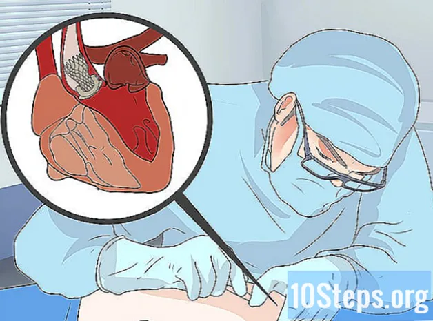 心臓弁の漏れを認識する方法