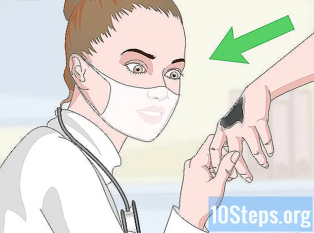 Ako odstrániť decht z pokožky