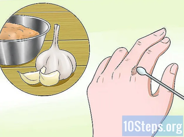 Πώς να αφαιρέσετε ένα κονδυλωμάτων χρησιμοποιώντας άλατα Epsom ή Daffodils