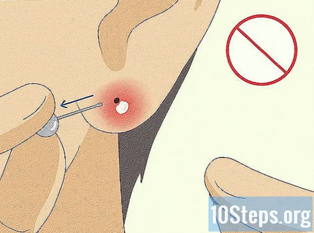 Hoe geïnfecteerde piercings te behandelen