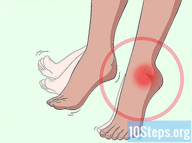 Ako liečiť pokles nohy súvisiaci s MS - Znalosti