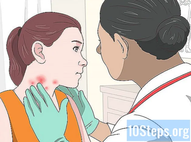 Làm thế nào để điều trị phát ban trên cổ