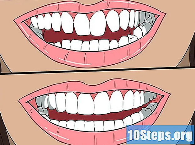 Sådan rettes tænder uden seler - Tips