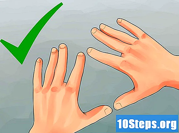 كيفية شفاء اليدين شديدة الجفاف