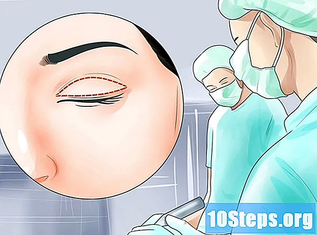 Wie man geschwollene Augen heilt