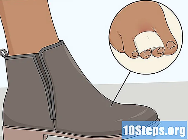 كيفية تضميد إصبع قدمك المصاب