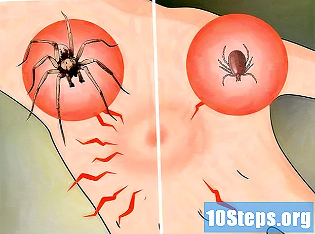 Bagaimana Mengidentifikasi Gigitan Laba-laba
