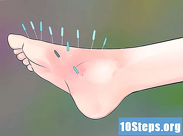 Kuidas toimida sügeleva nahaga menopausi ajal - Vihjeid