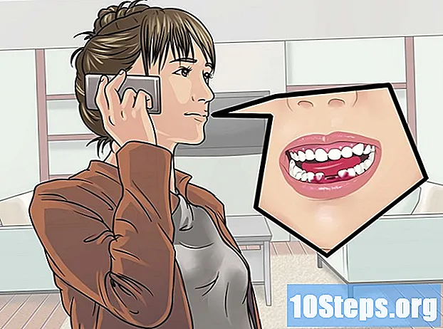 Com aturar el sagnat després d’haver-te obtingut un dents tous - Consells