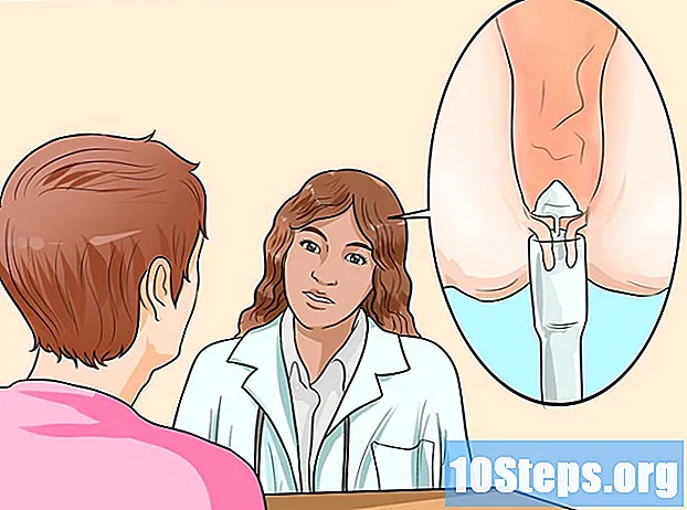 Kako smanjiti bol od hemoroida